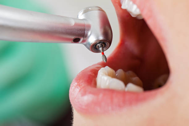 Best Emergency Cosmetic Dentistry in South Fulton, GA